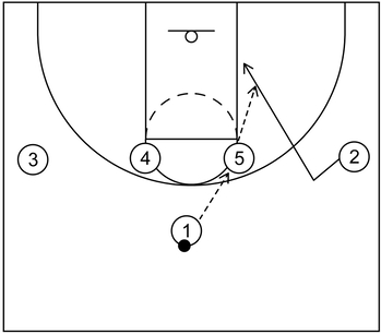 1-4 high set play - Example 4 - Part 1