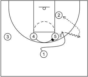 1-4 high set play - Example 4 - Part 2