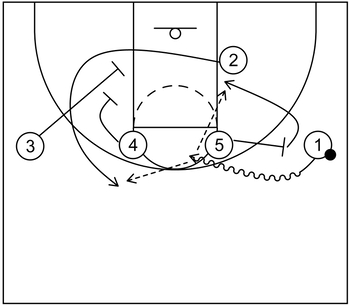 1-4 high set play - Example 4 - Part 3