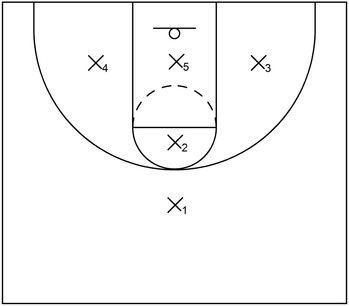 1-1-3 zone defense: Initial formation