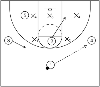 Vs. 2-3 zone - Example 1 - Part 1