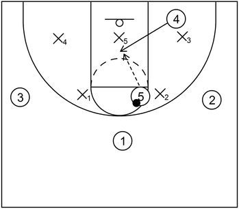 Vs. 2-3 zone - Example 2A - Part 2