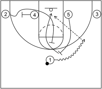 Set Play #6 - Screener the screener action